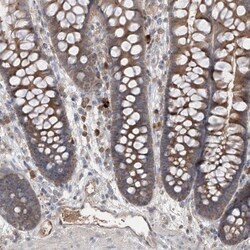 Endothelin-1 Antibody, Novus Biologicals:Antibodies:Primary Antibodies